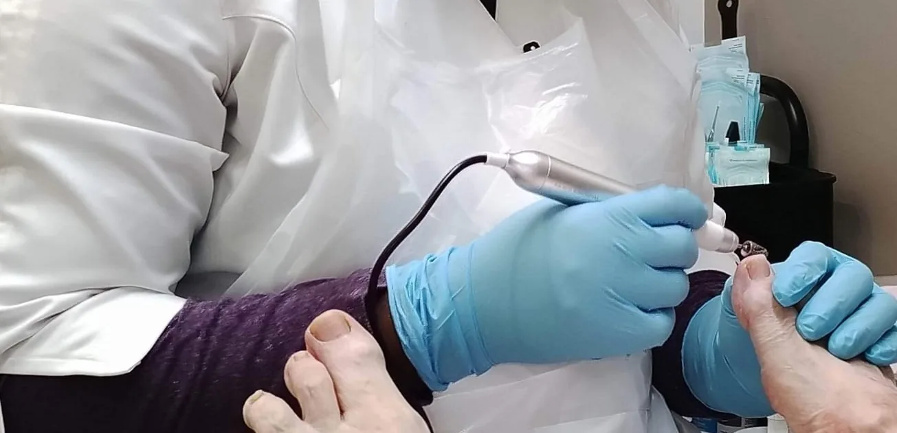 Rebecca Carole Ngo Biyik ponce un ongle, gants et instrument stérilisé
