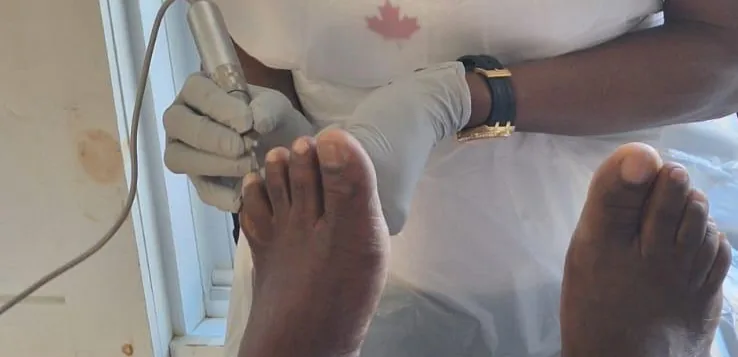Viviane Peguy Kouassi ponce un ongle, gants et instrument stérilisé